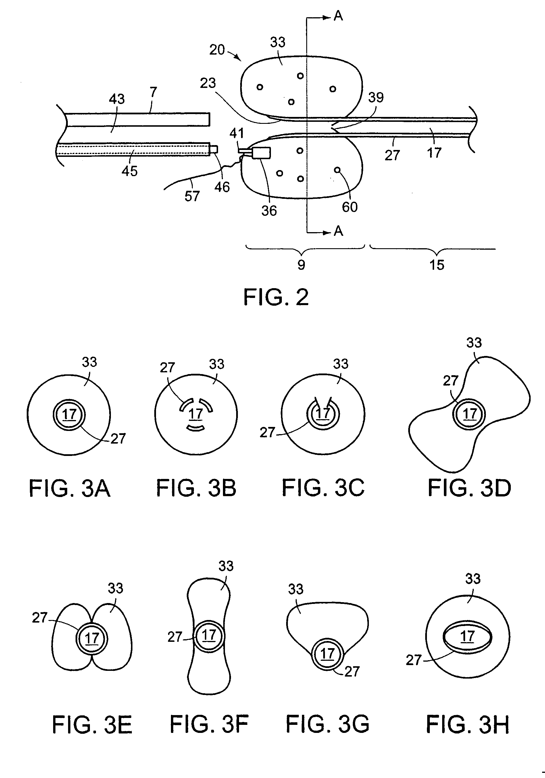 Ureteral stent with end-effector and related methods