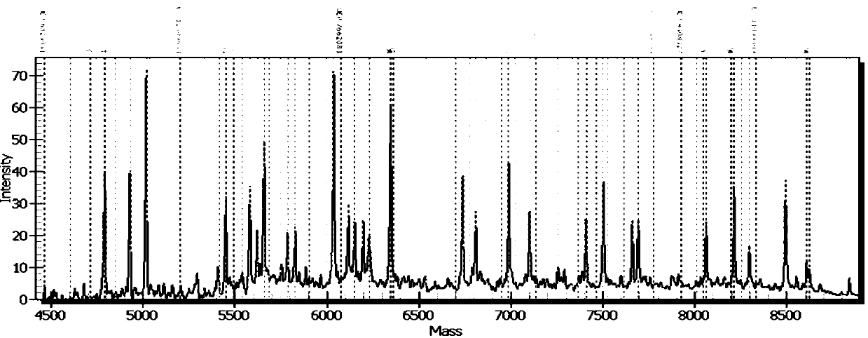 Detection product which is prepared from specific primer composition and used for judging individualized medication of benazepril