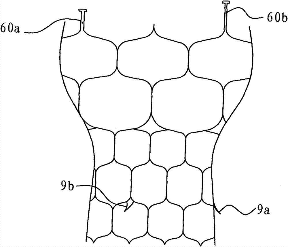 Valvular prosthetic replacement device with buffer action and stent