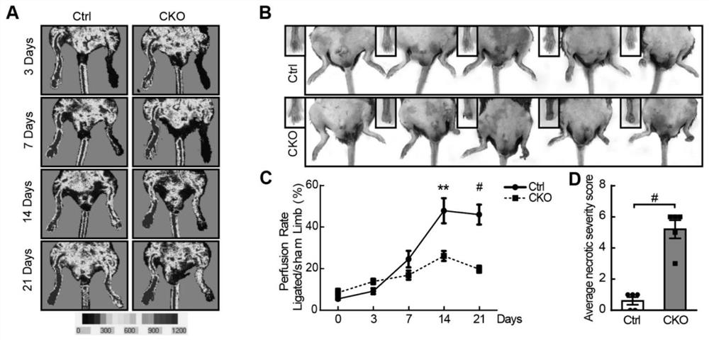 Polypeptide for promoting angiogenesis and pharmaceutical use of polypeptide