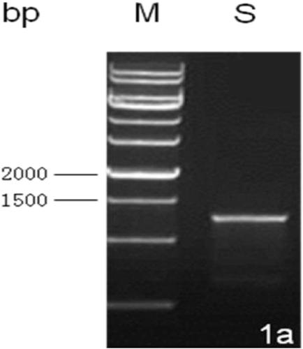 Method for distinguishing early and late infection of syphilis