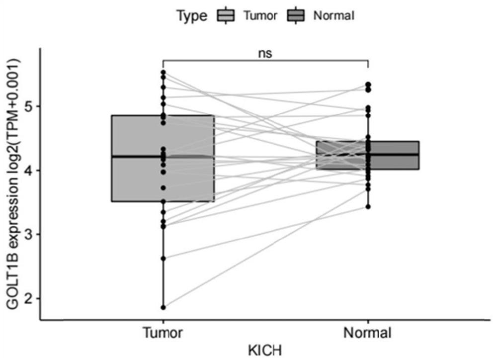 Application of GOLT1B in prognosis of kidney cancer