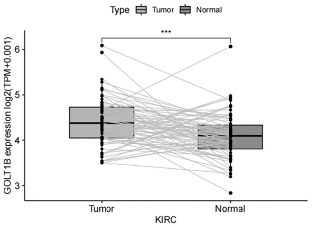 Application of GOLT1B in prognosis of kidney cancer