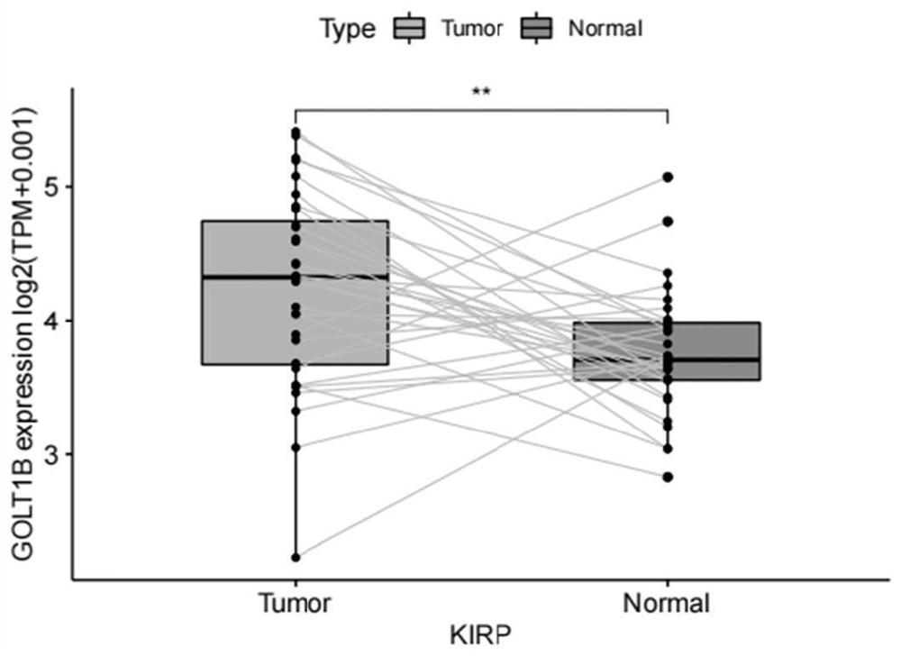 Application of GOLT1B in prognosis of kidney cancer