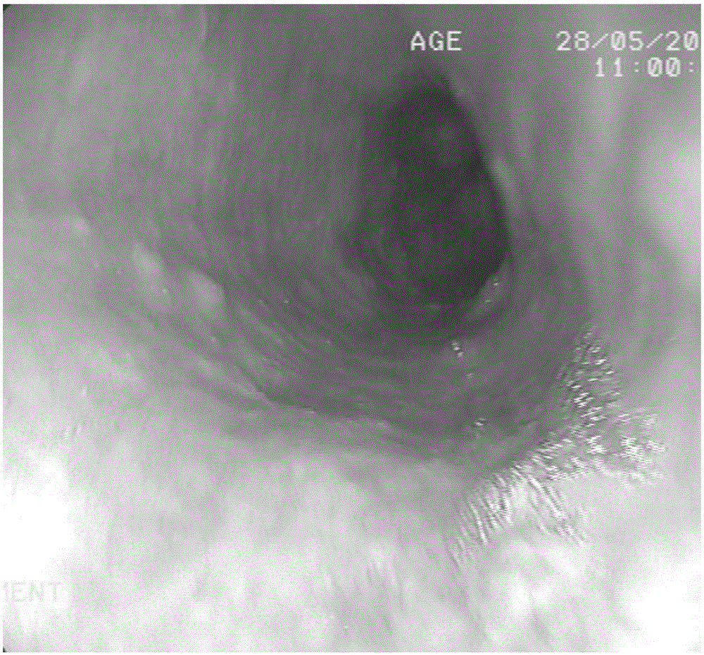 Esophageal-mucosa staining combination set