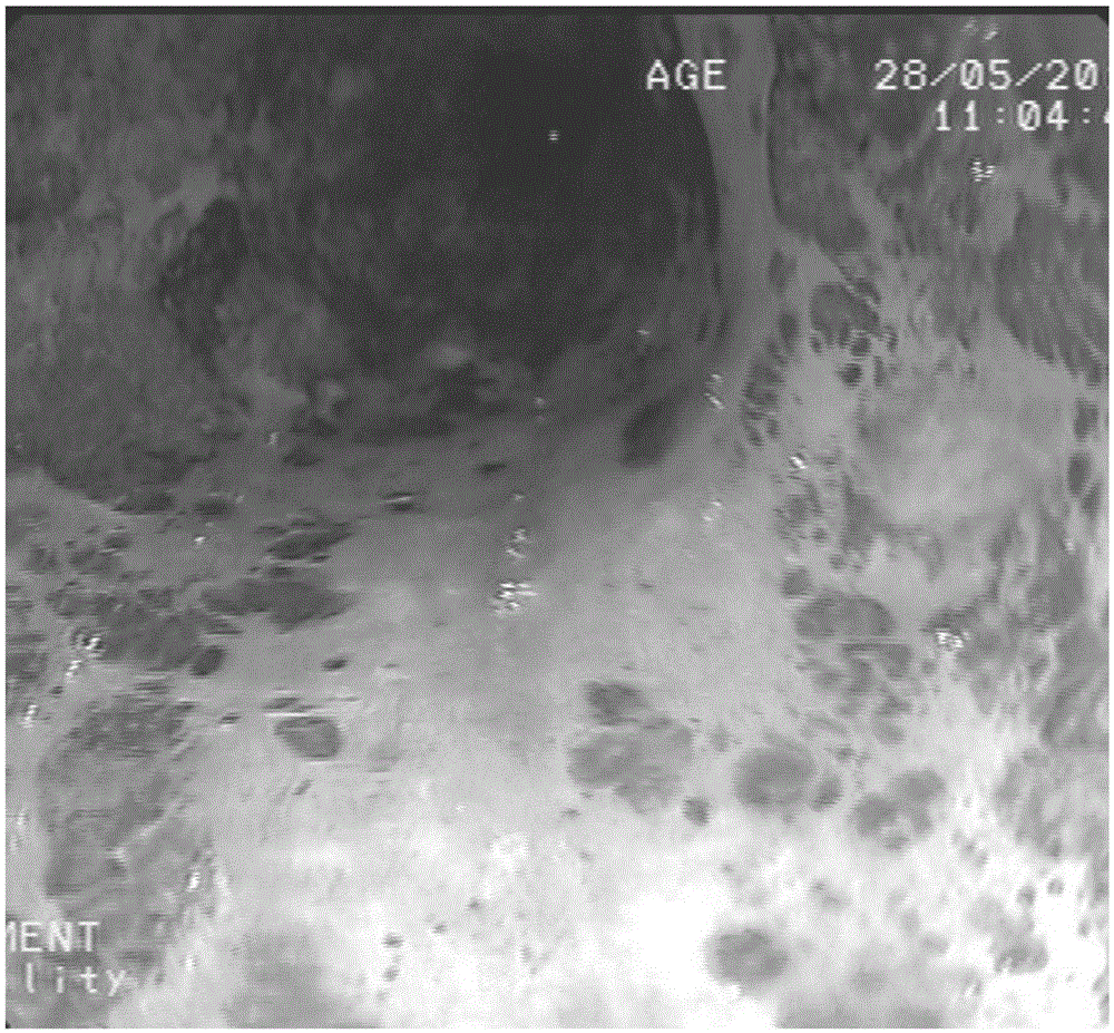 Esophageal-mucosa staining combination set