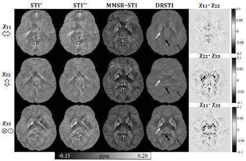 Human brain magnetic susceptibility tensor imaging method based on cross mode