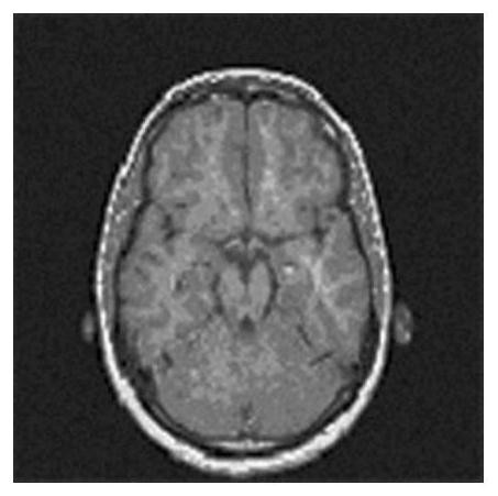 Medical image robust watermarking method based on Tetrolet-DCT