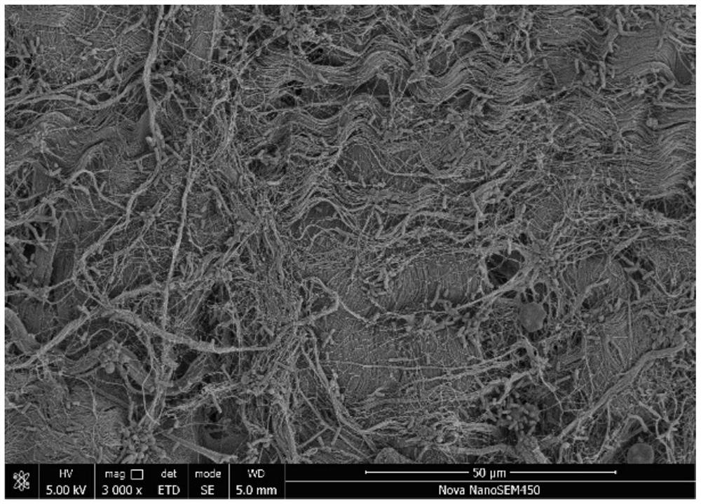 A kind of valve material with synergistic anticoagulation and anticalcification functions and preparation method thereof