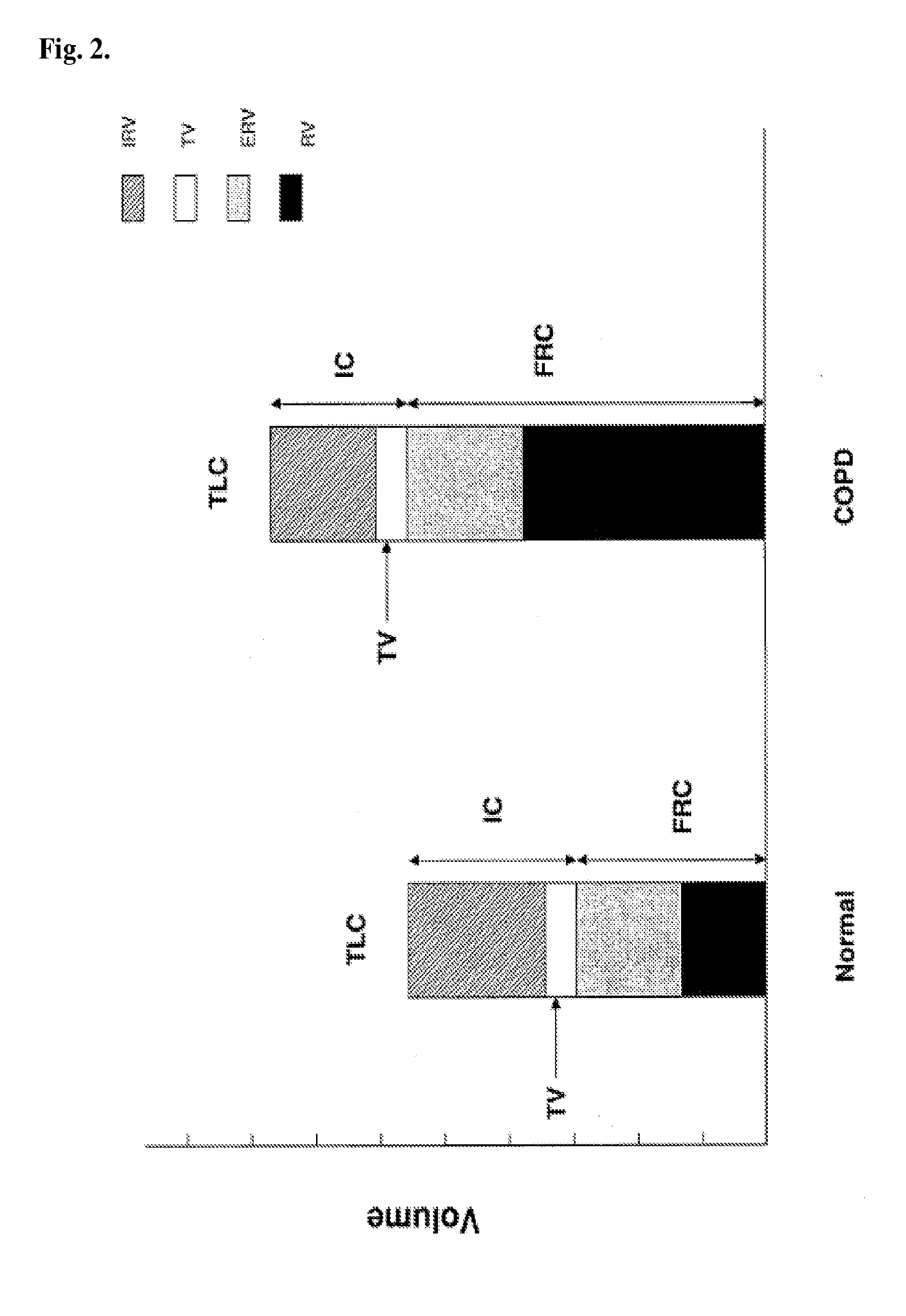 Apparatus and methods for assisting breathing