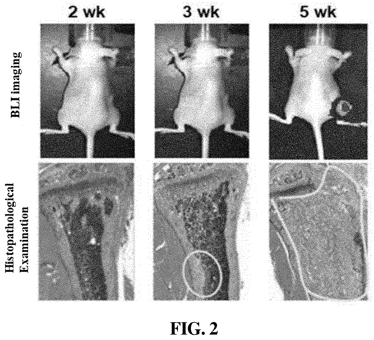 Composition for diagnosis of bone metastasis of cancer and kit comprising same