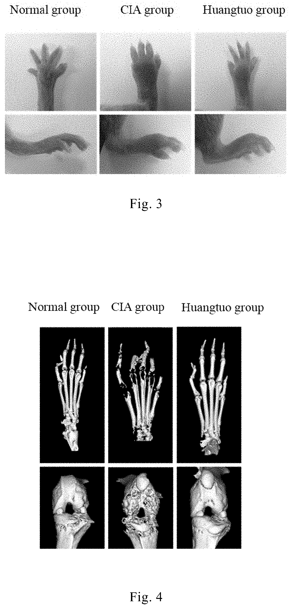 Use of cimicifugae rhizoma triterpenoid saponin extract, actein, and deoxyactein