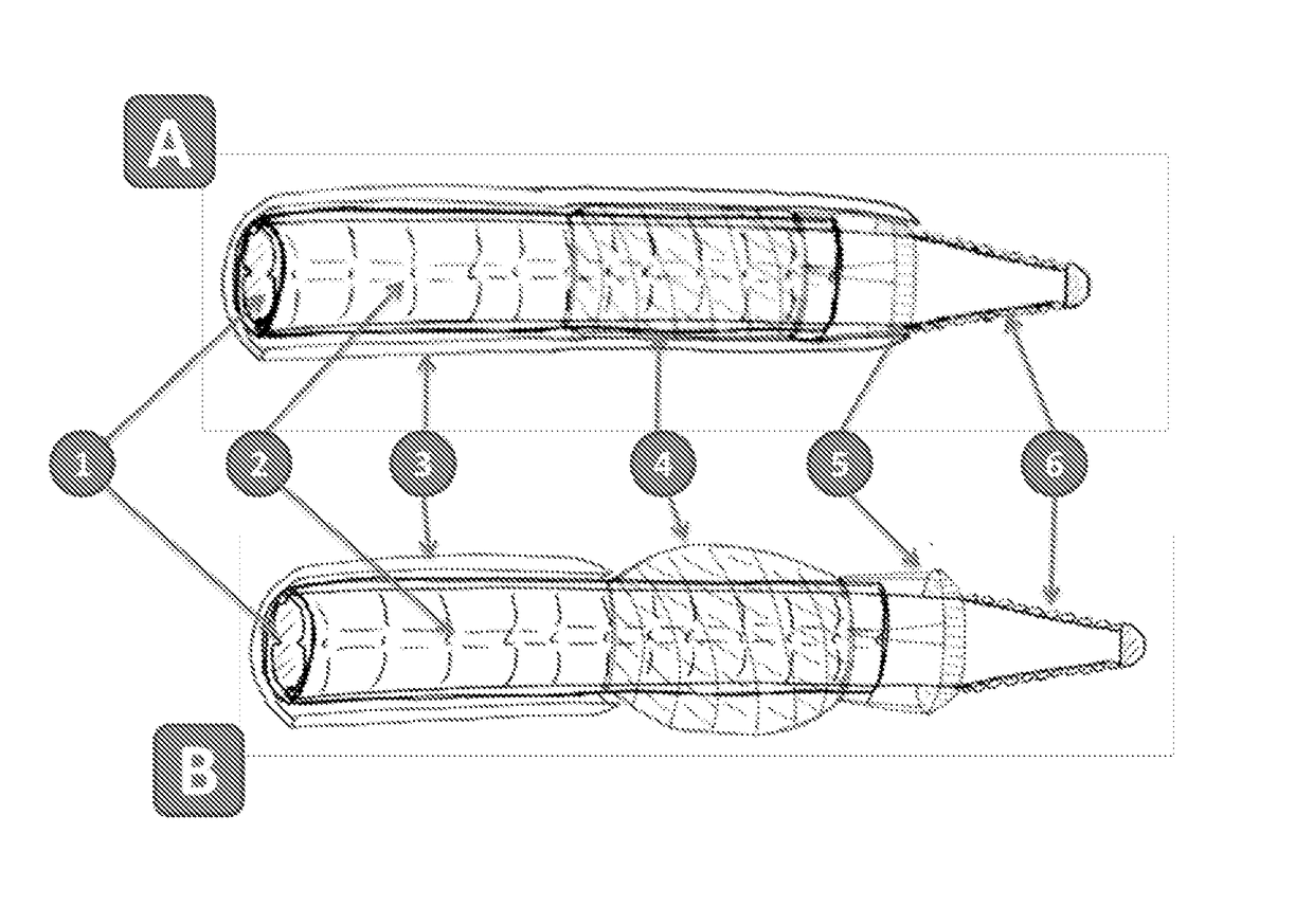 Devices and Methods for Treating Occlusion of the Ophthalmic Artery