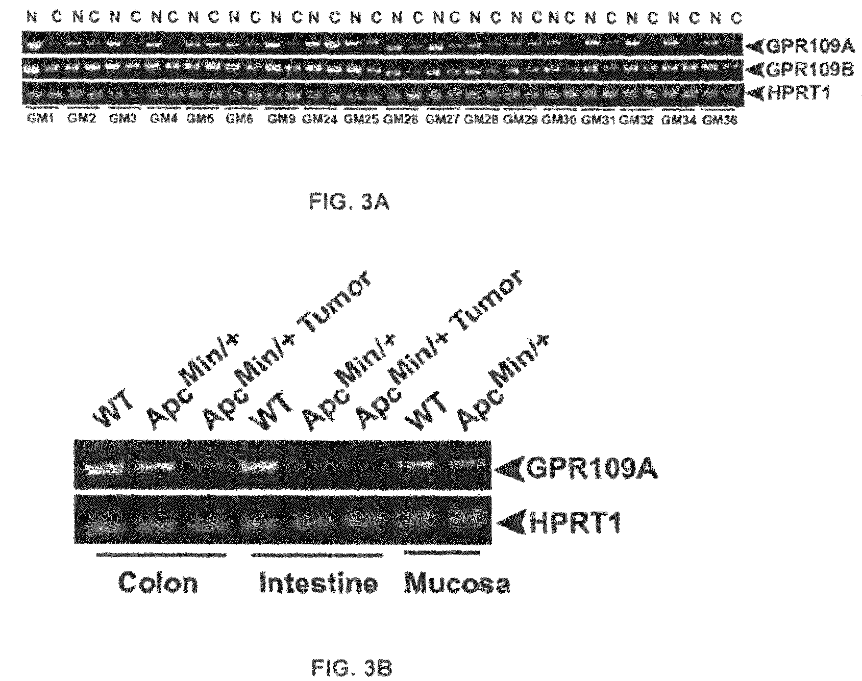 Compositions comprising a GPR109 ligand for treating disorders of the digestive tract and/or cancer