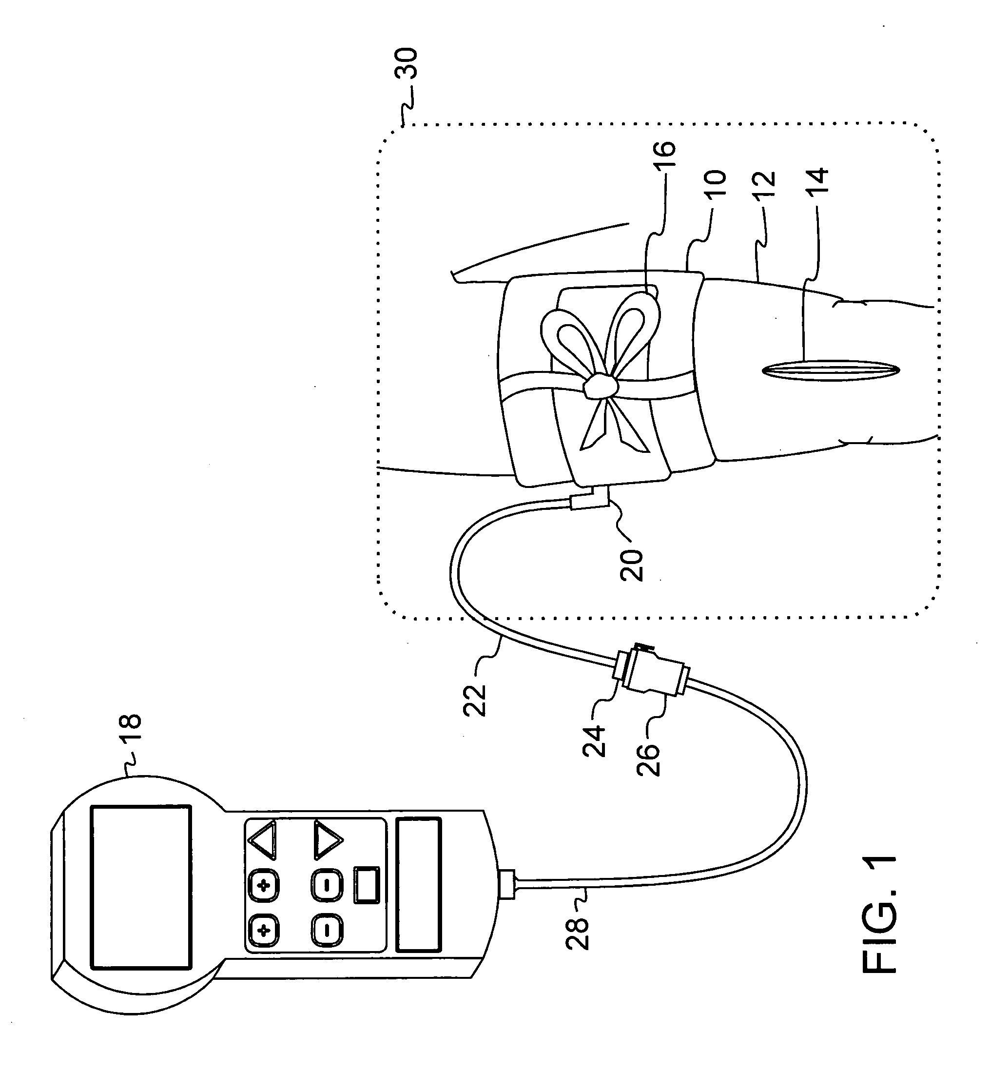 Low-cost disposable tourniquet cuff