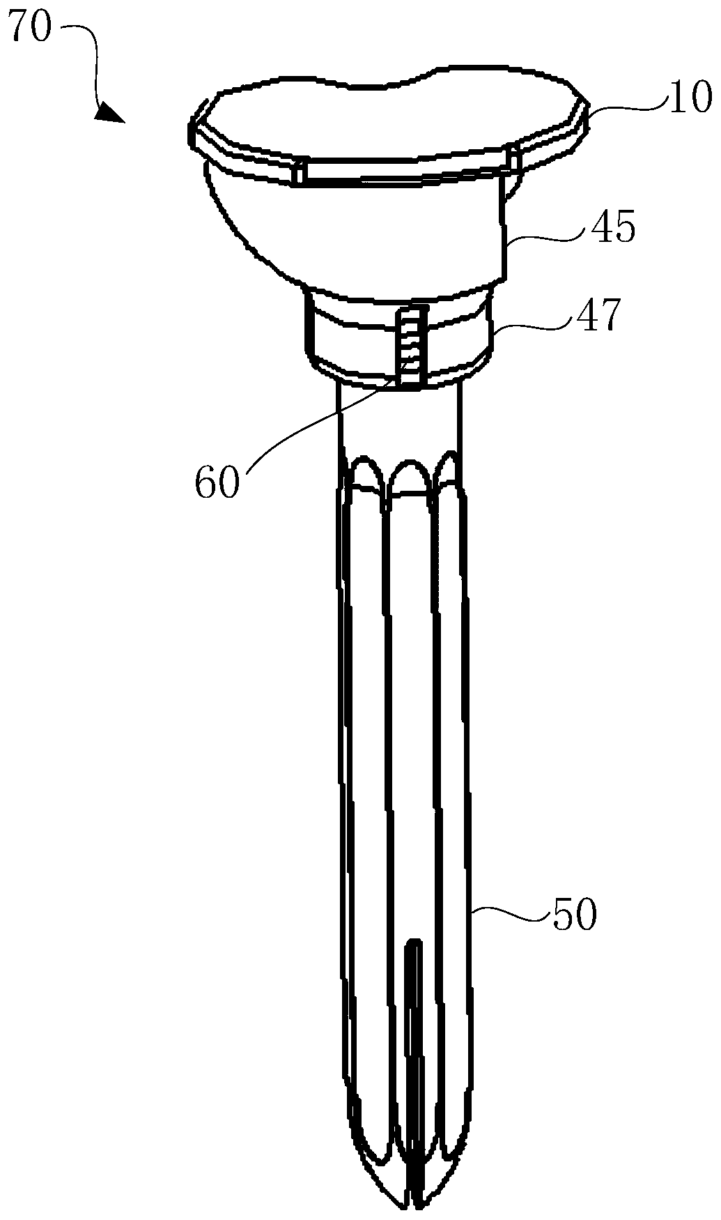 Knee joint prosthesis