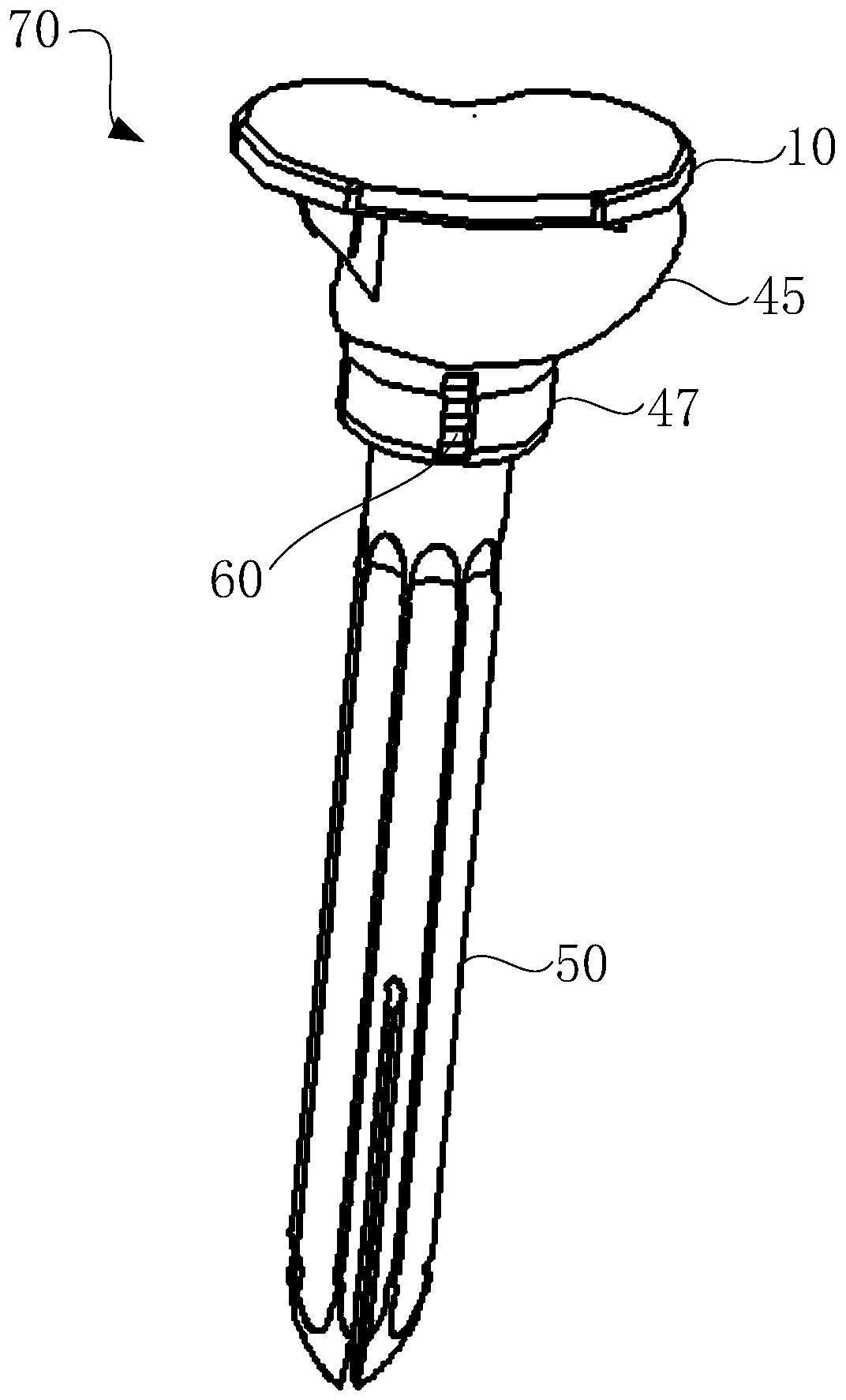 Knee joint prosthesis