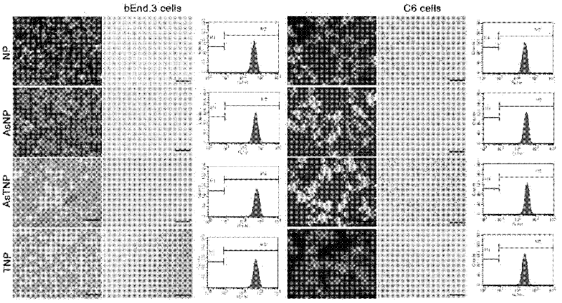 Cascade brain-targeting drug delivery system as well as preparation method and application thereof