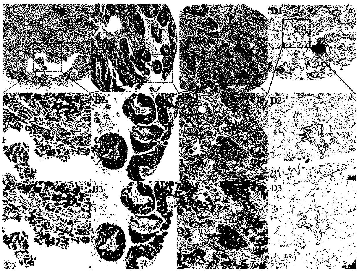 Application of GPR115 gene in preparation of anti-lung cancer drug and diagnostic kit thereof