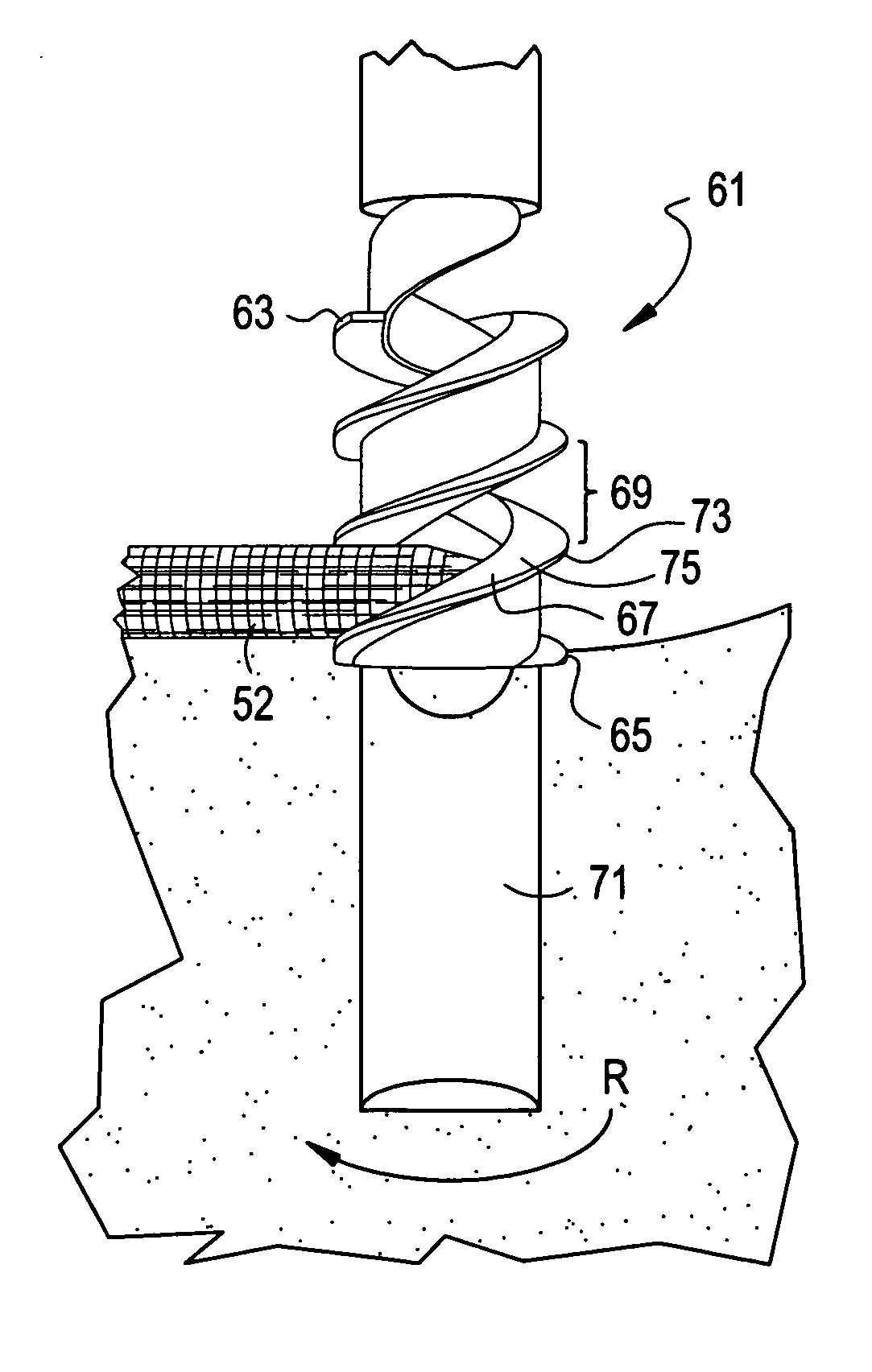 Intervertebral ligament having a helical bone fastener