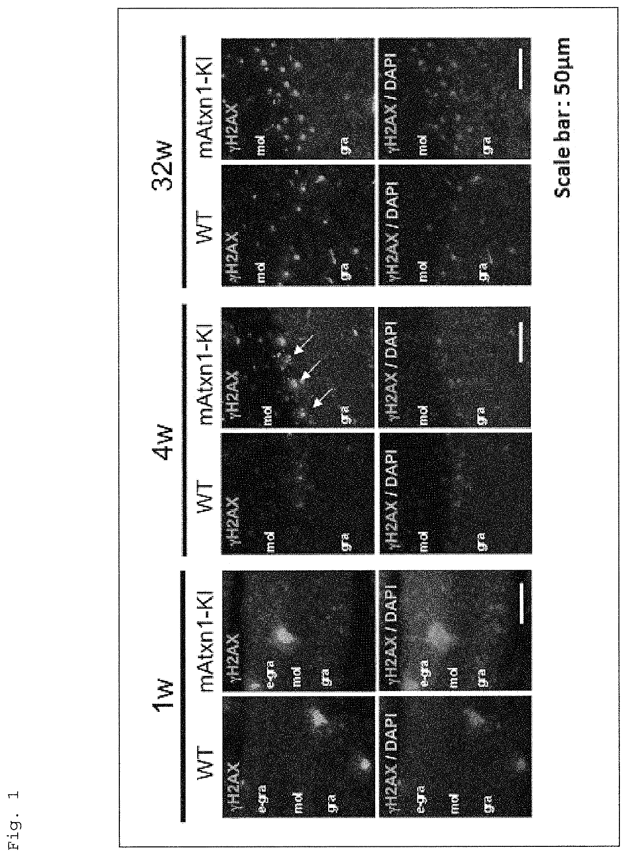 Methods for treating spinocerebellar ataxia type I using RPA1