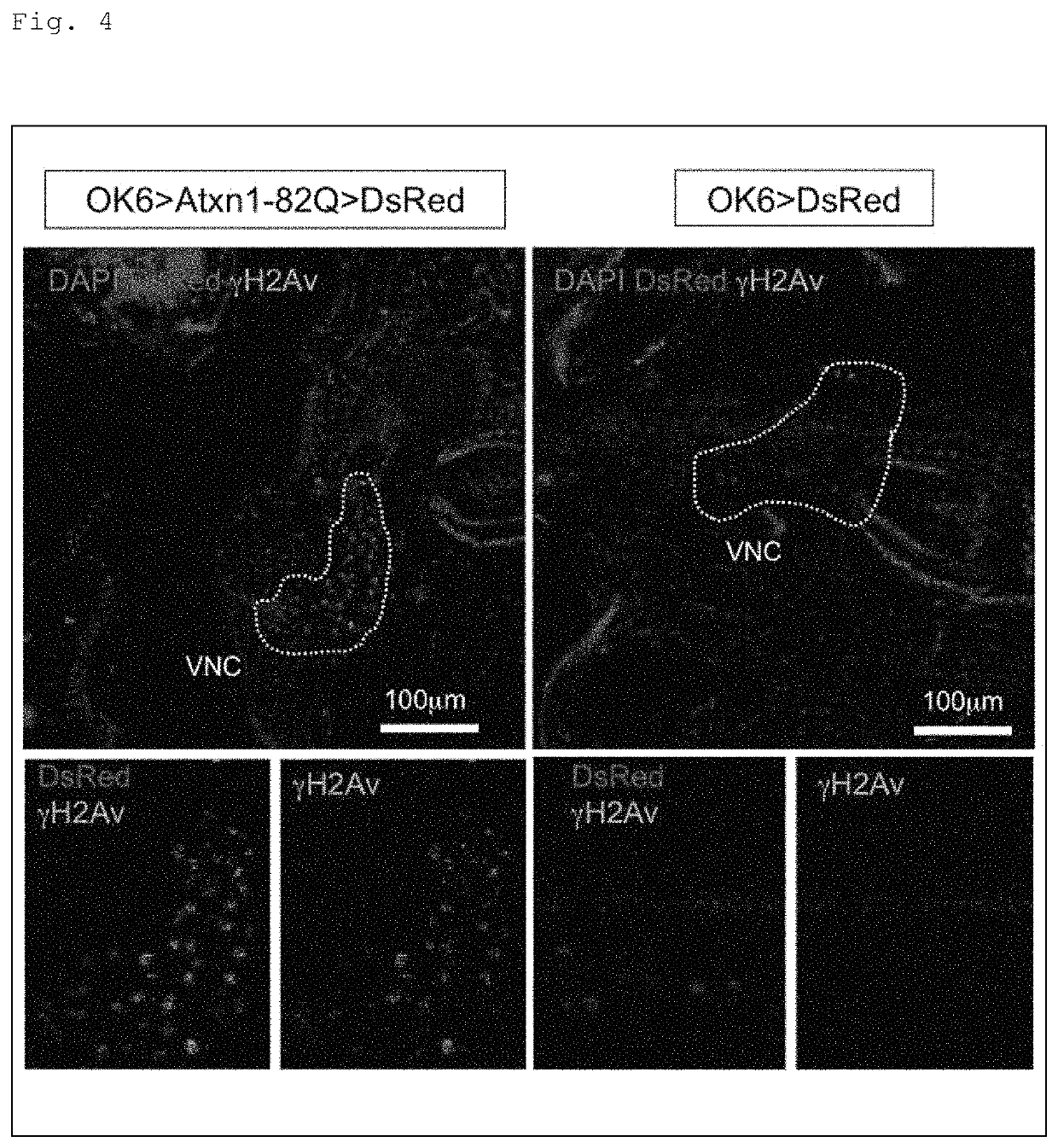 Methods for treating spinocerebellar ataxia type I using RPA1