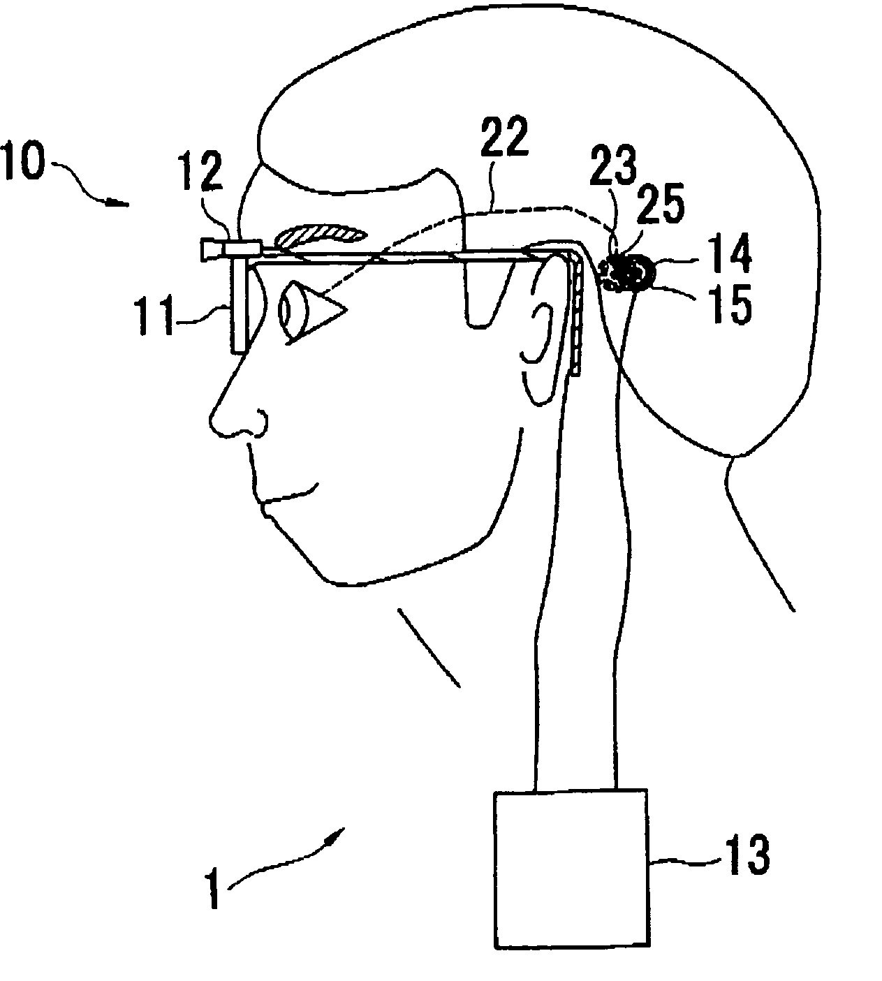 Visual restoration aiding device