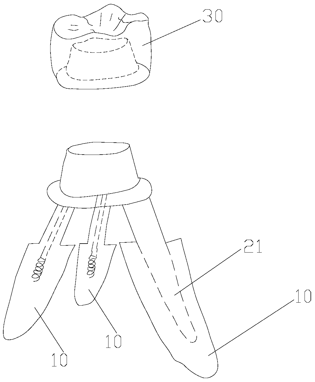 Anatomical root implant, dental restoration having the same, and manufacturing method of dental restoration