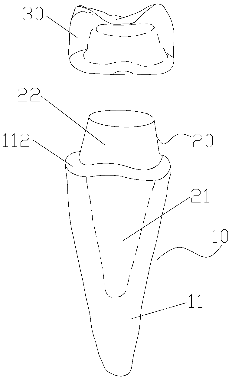 Anatomical root implant, dental restoration having the same, and manufacturing method of dental restoration