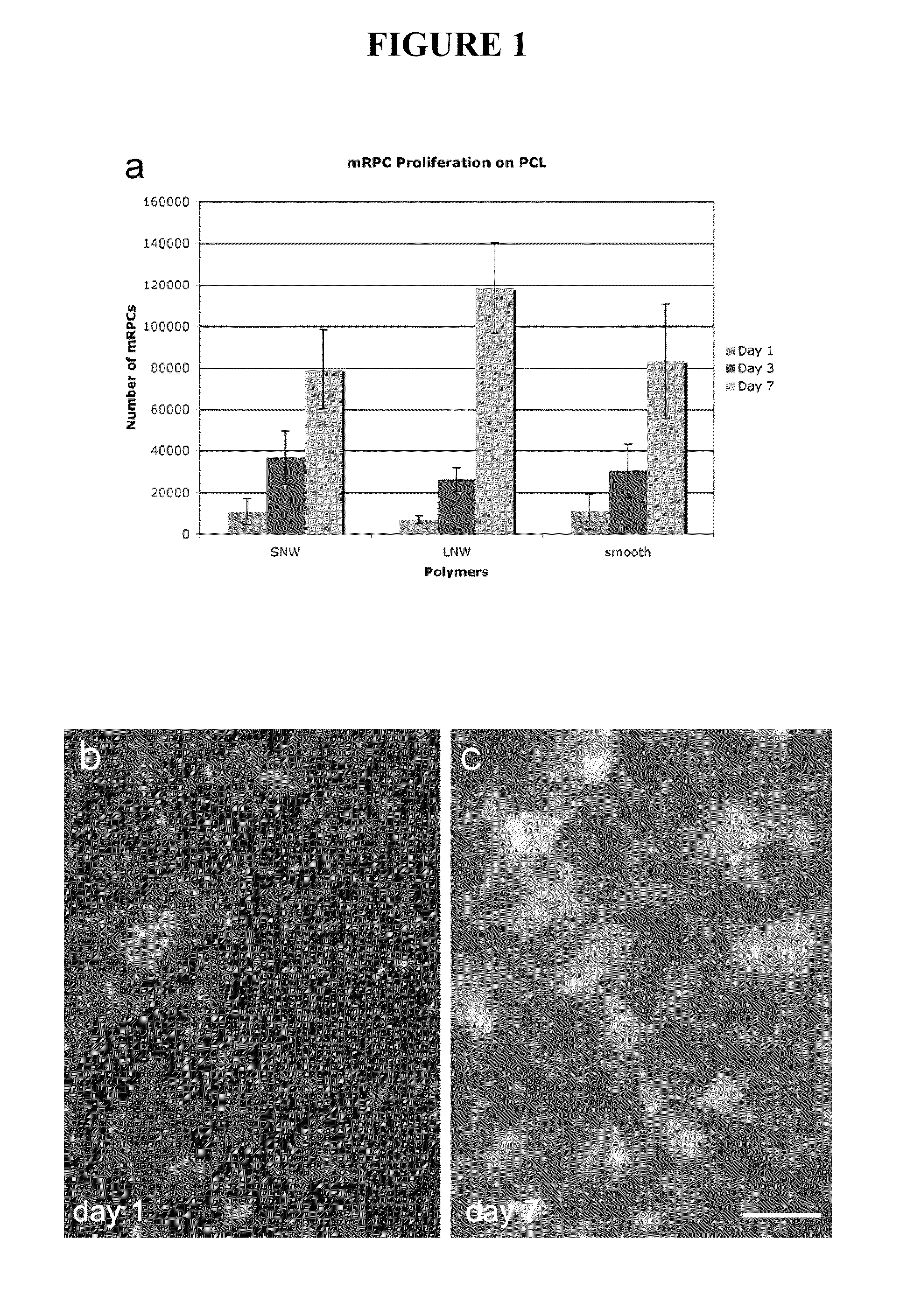 Ocular Scaffolds and Methods for Subretinal Repair of Bruch's Membrane