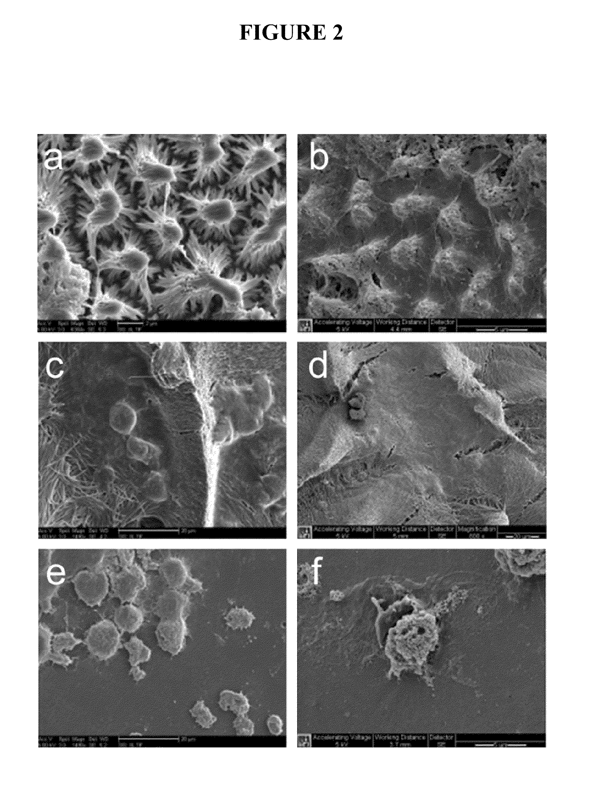 Ocular Scaffolds and Methods for Subretinal Repair of Bruch's Membrane