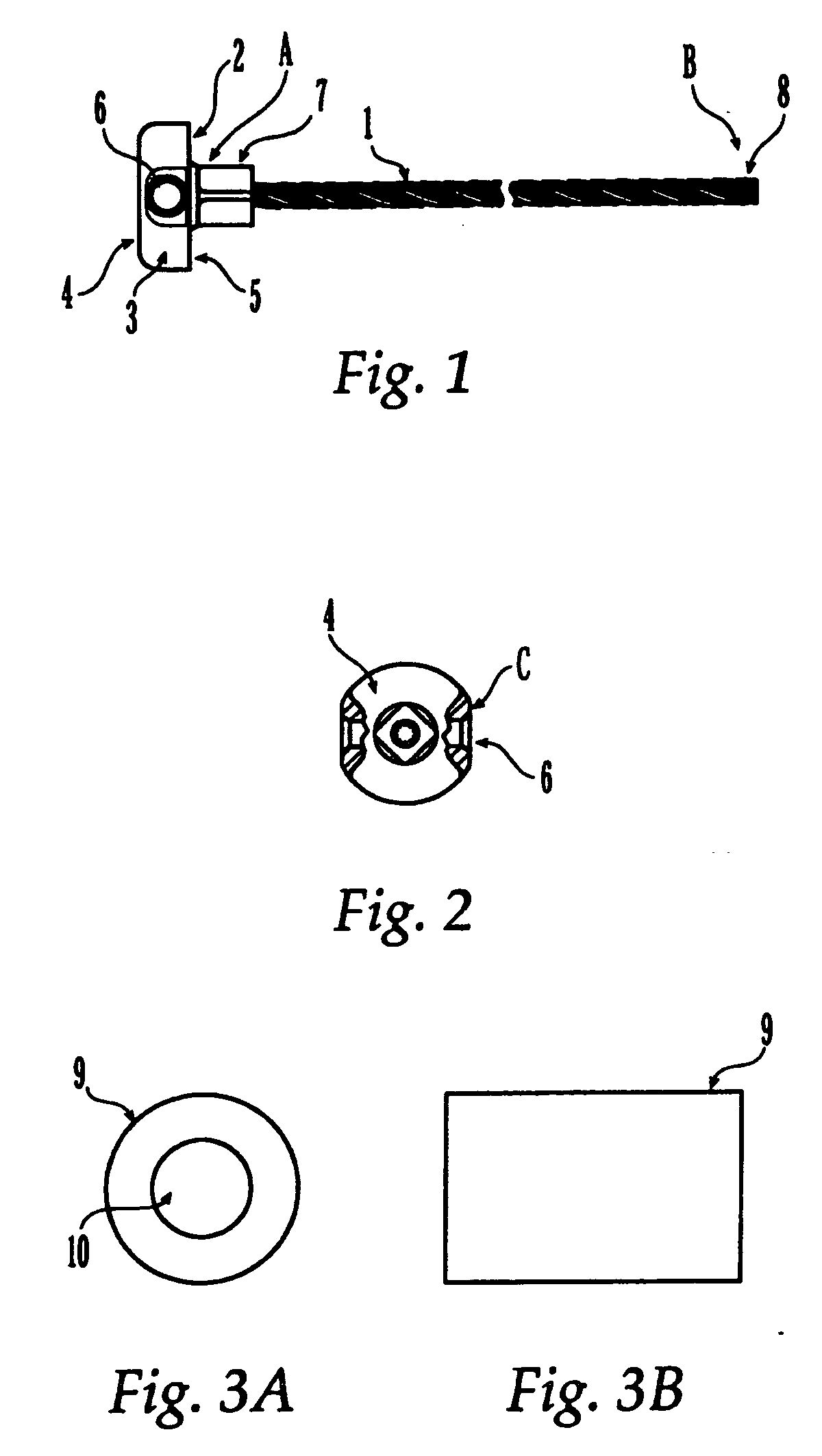 Sternal reconstruction system