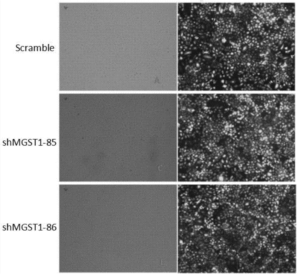 Application of MGST1 gene in proliferation and apoptosis of lung adenocarcinoma cell