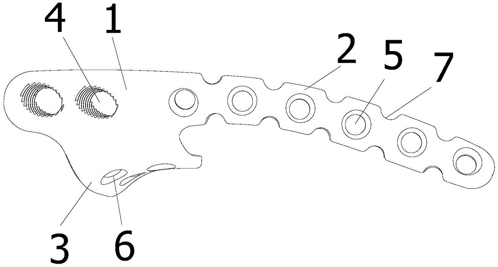 An acetabular anterior and posterior column combined steel plate