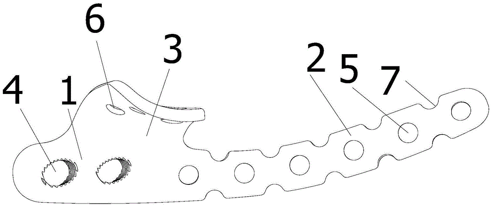 An acetabular anterior and posterior column combined steel plate