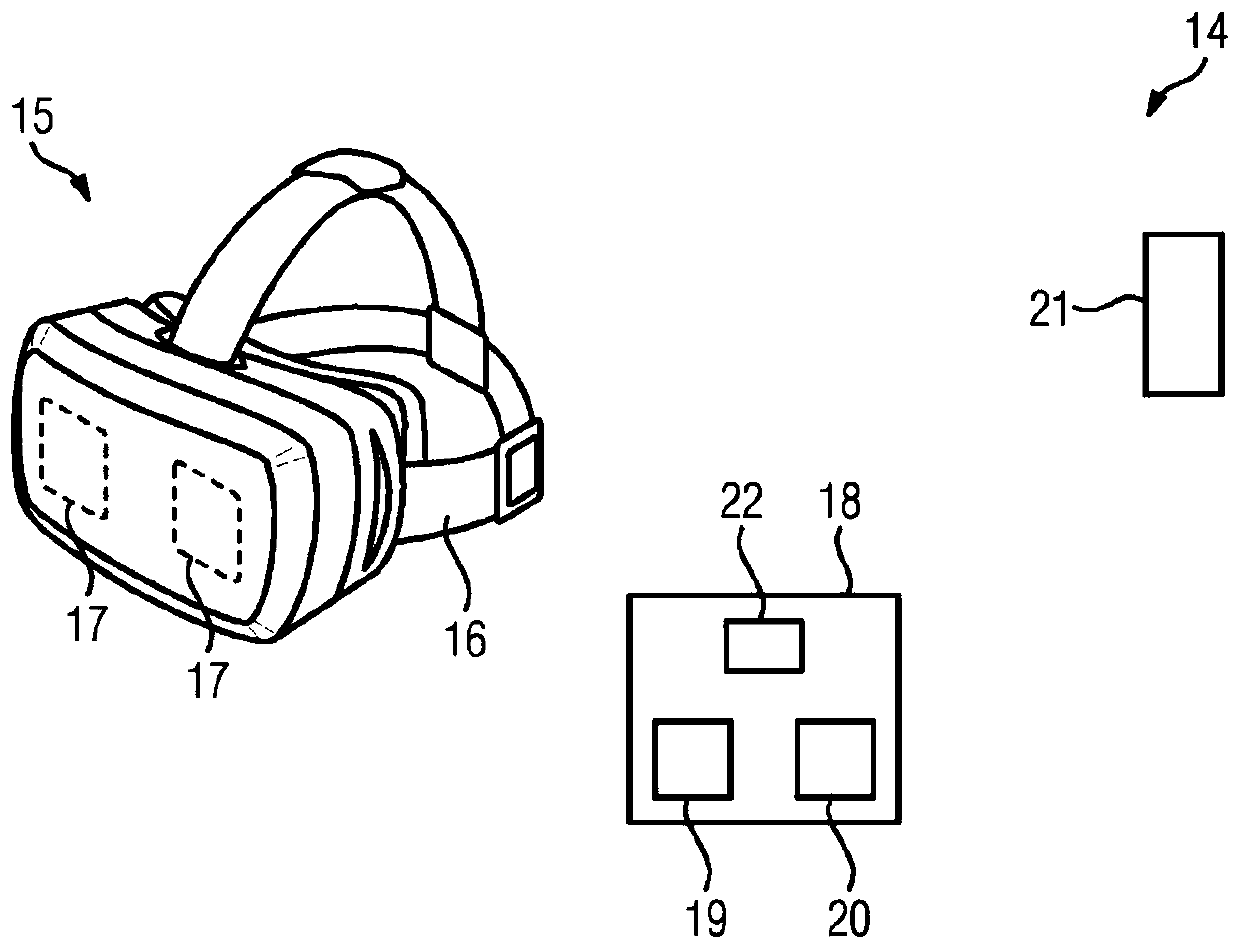 Method and presentation device for post processing and displaying a three-dimensional angiography image data set