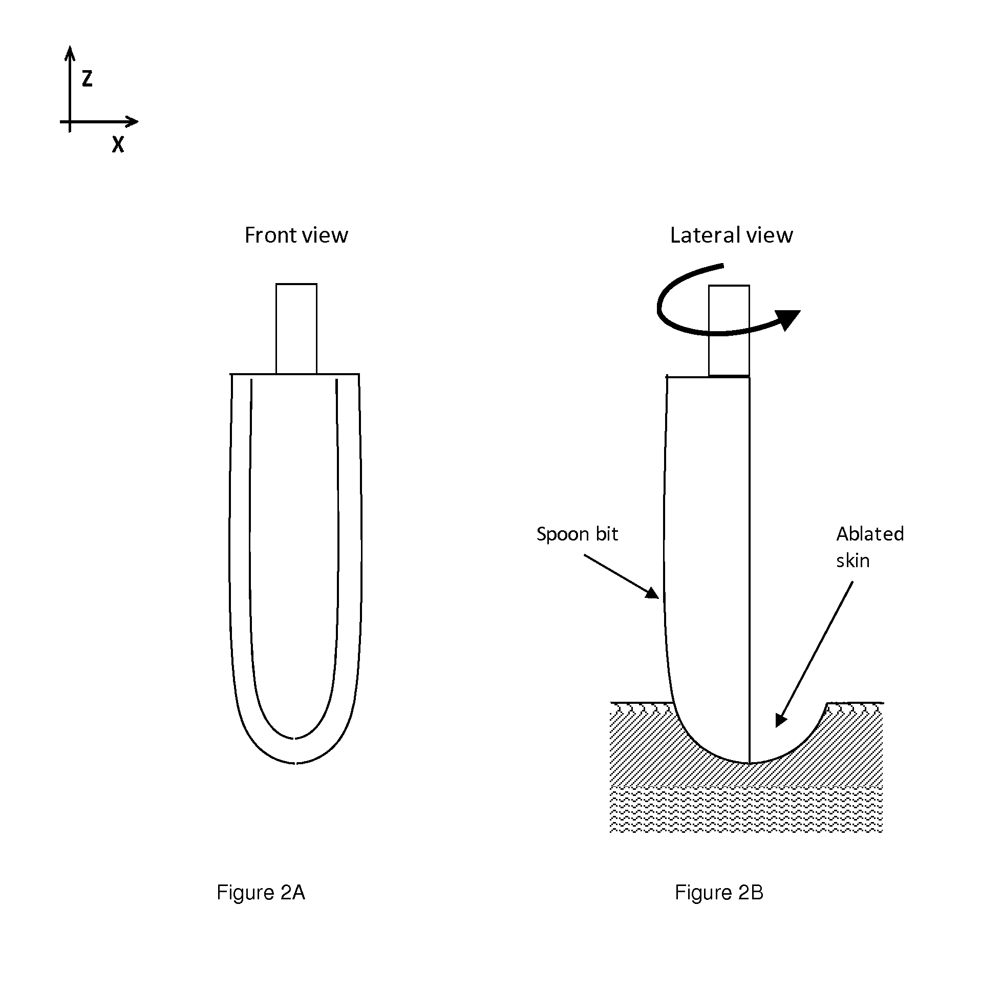 Methods and apparatuses for skin treatment using non-thermal tissue ablation