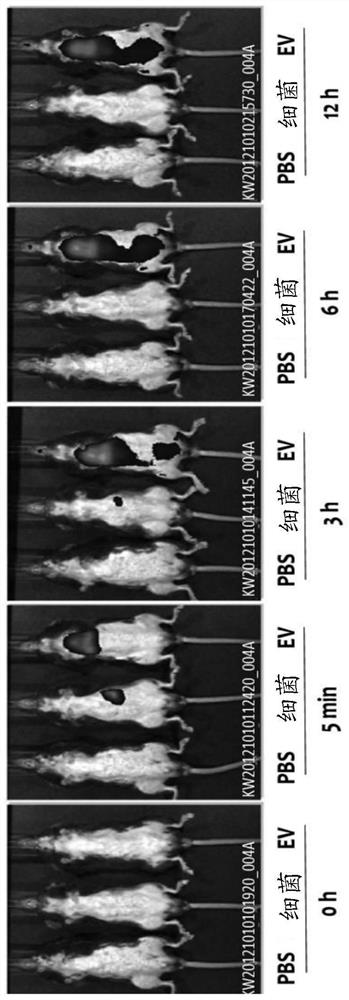 Nanovesicles derived from coprococcus sp. bacteria, and use thereof