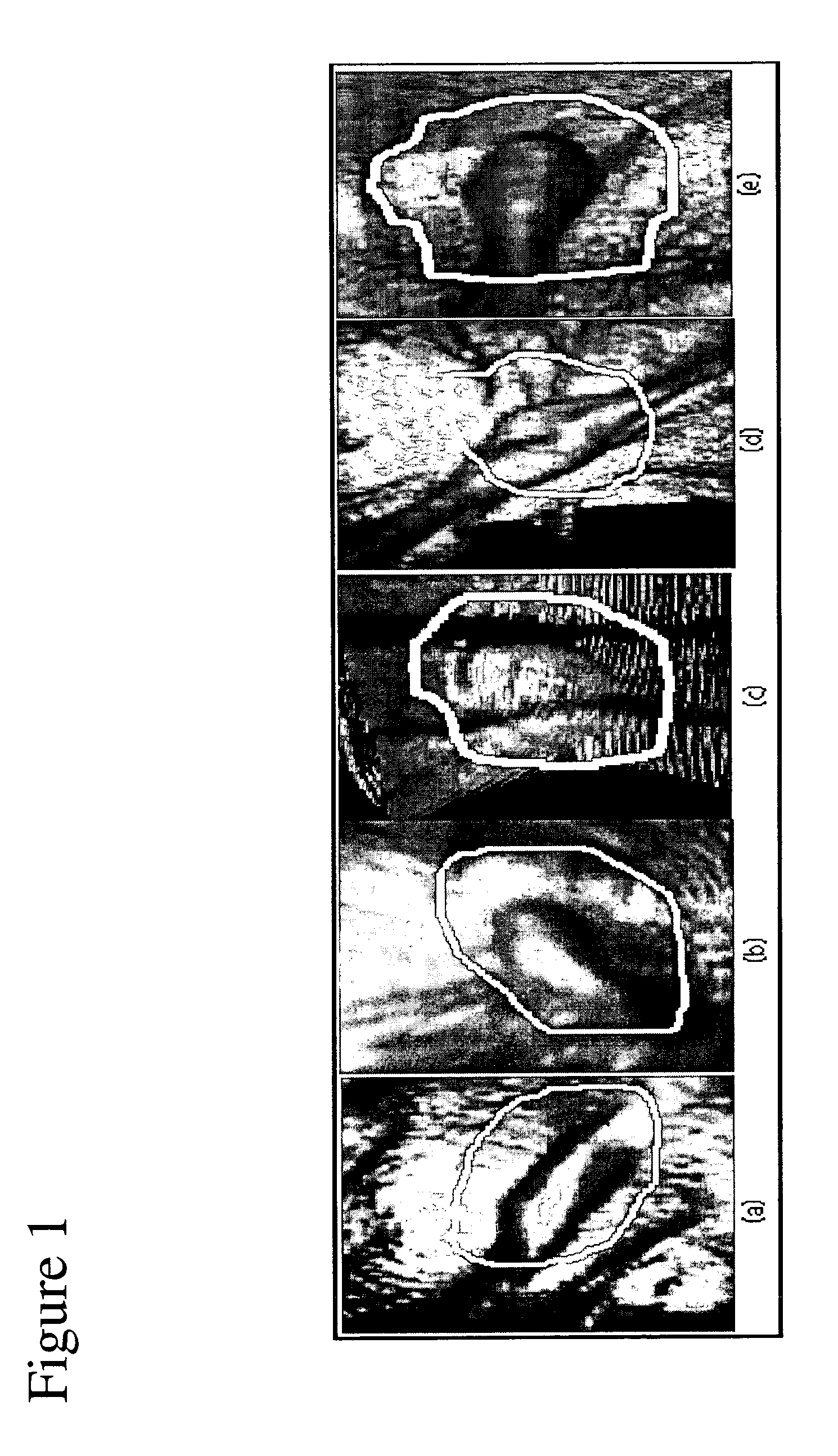 Three-dimensional pattern recognition method to detect shapes in medical images