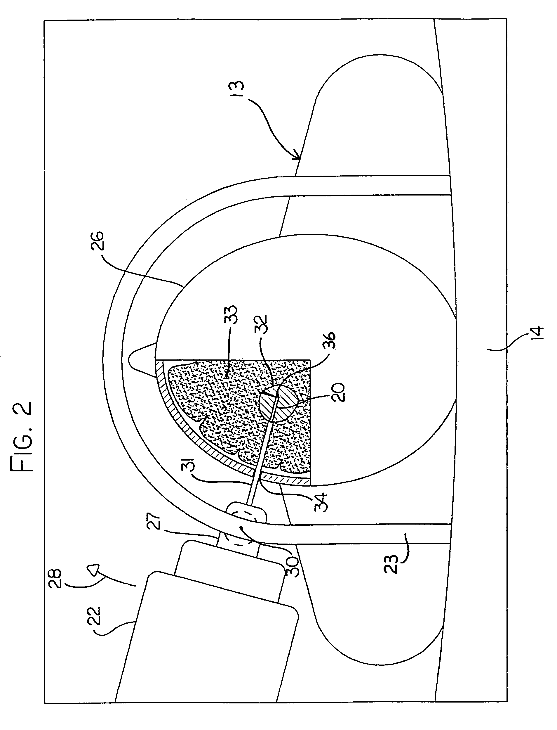 Hyperthermia treatment and probe therefor