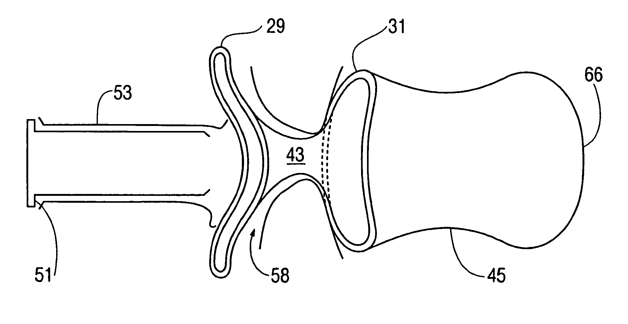 Female condom employing tensegrity principle