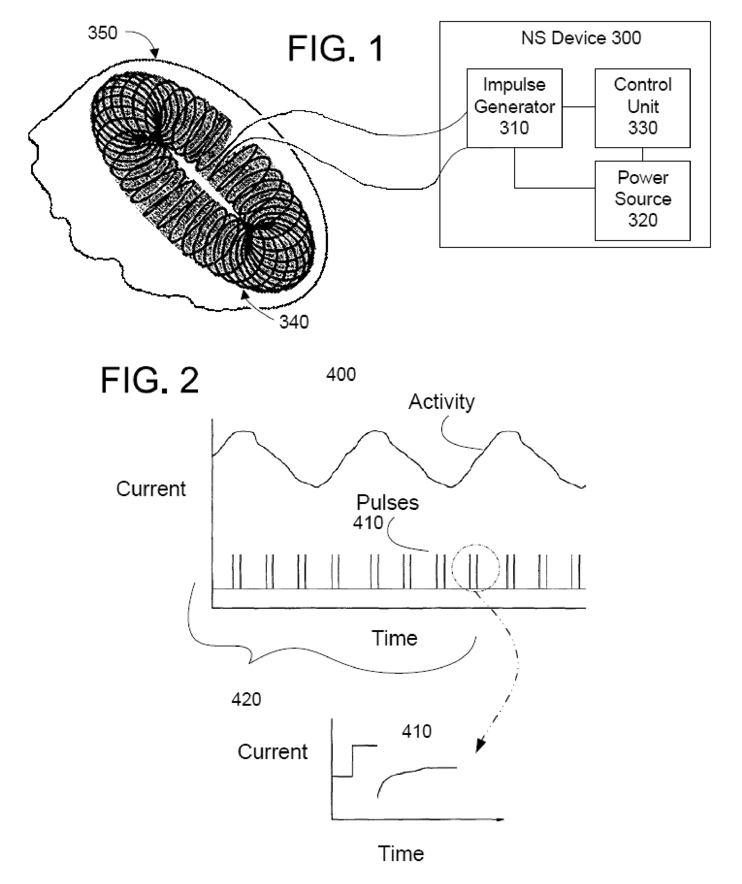 Non-invasive treatment of a medical condition by vagus nerve stimulation