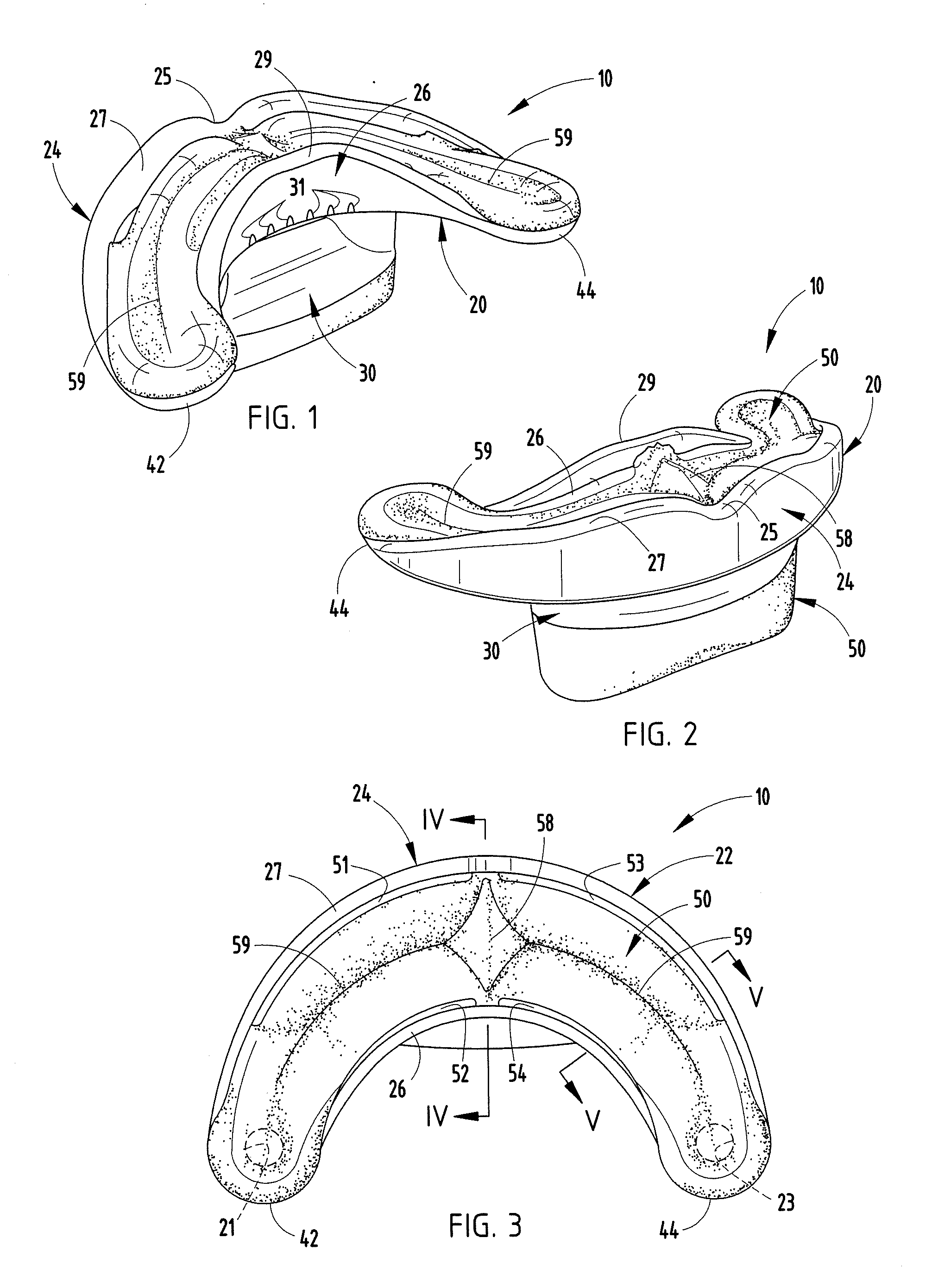 Oral orthosis