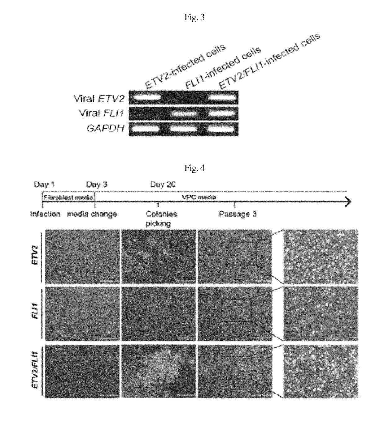 Composition for inducing direct transdifferentiation of somatic cell into vascular progenitor cell, and use thereof