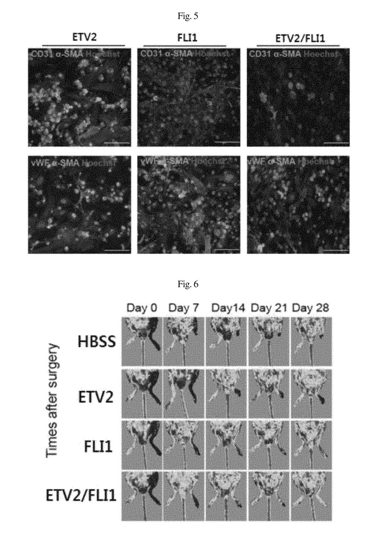 Composition for inducing direct transdifferentiation of somatic cell into vascular progenitor cell, and use thereof