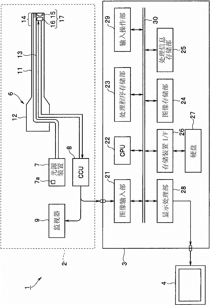 Diagnosis assistance apparatus