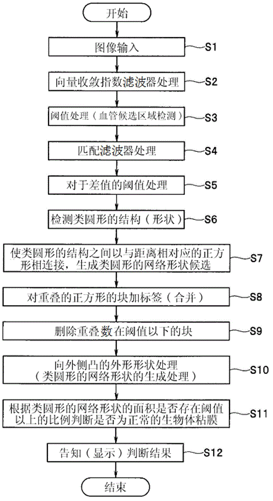 Diagnosis assistance apparatus