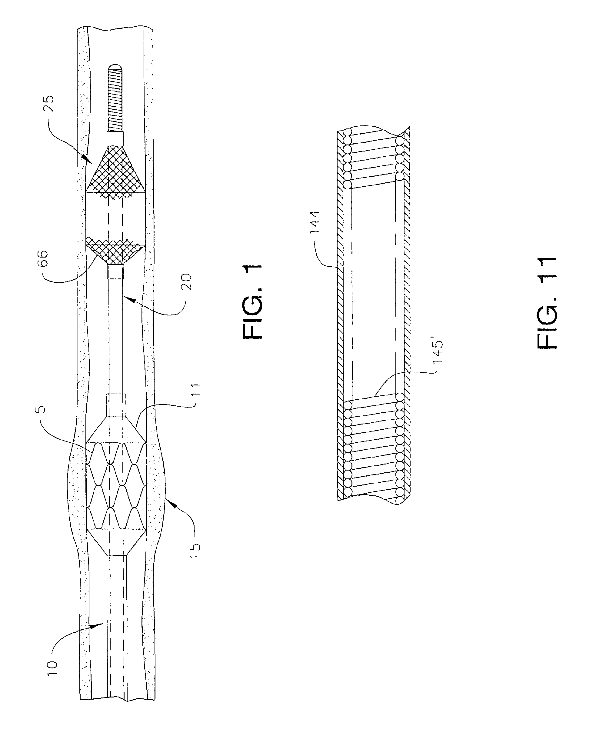 Guidewire apparatus for temporary distal embolic protection