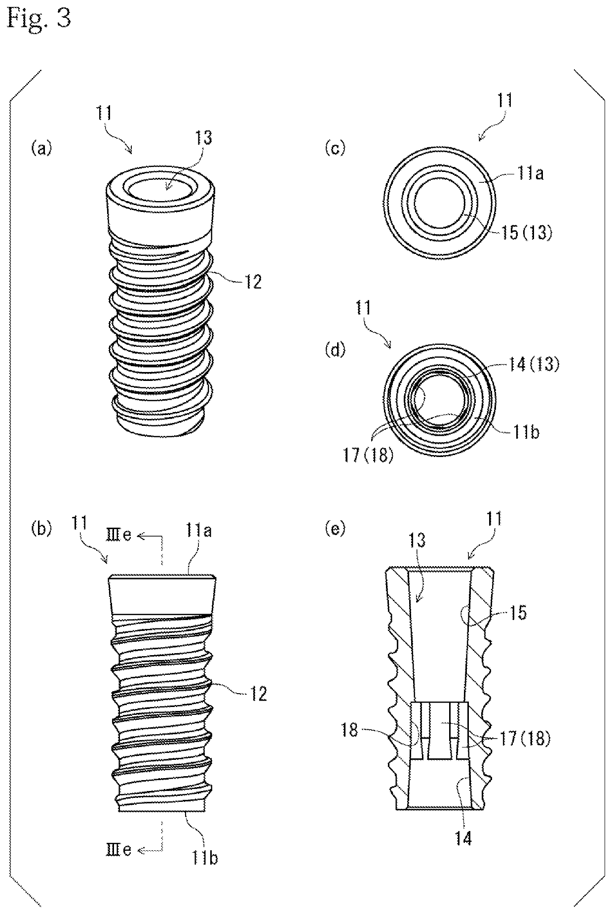 Fixture and implant