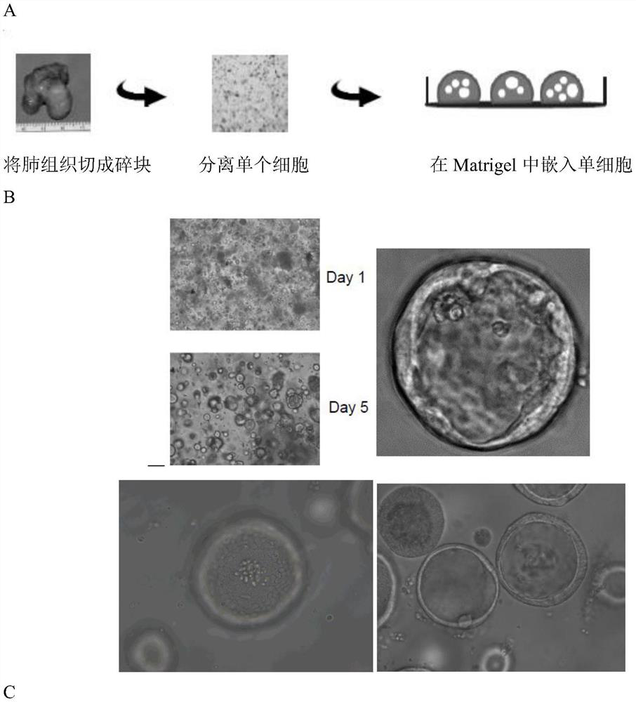 Respiratory tract organoid culture system and method for constructing bocavirus infection model